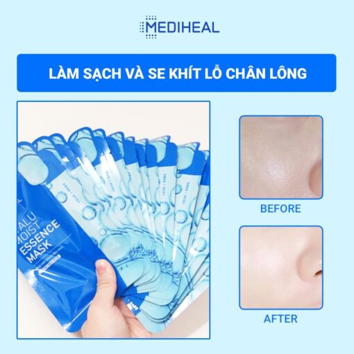 Mặt Nạ Dưỡng Ẩm Chuyên Sâu Mediheal Hyalu Moist Essence Mask 02168 - Hình ảnh 3