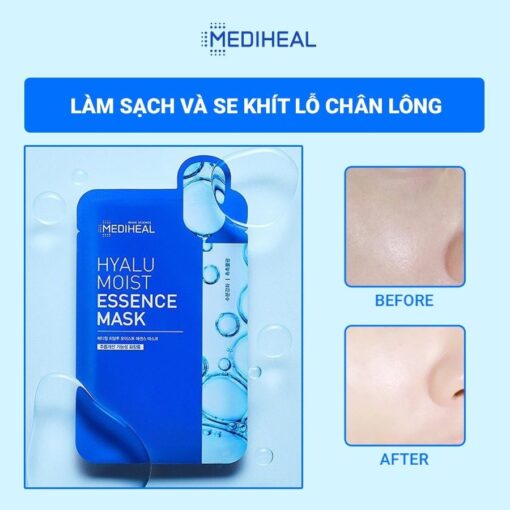 Mặt Nạ Dưỡng Ẩm Chuyên Sâu Mediheal Hyalu Moist Essence Mask 02168 - Hình ảnh 4